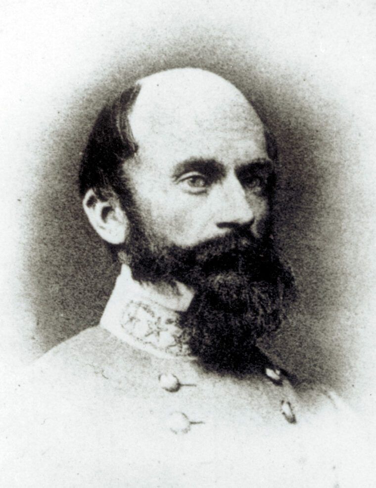 Confederate General Richard S. Ewell lost his leg to a Union Minié ball.