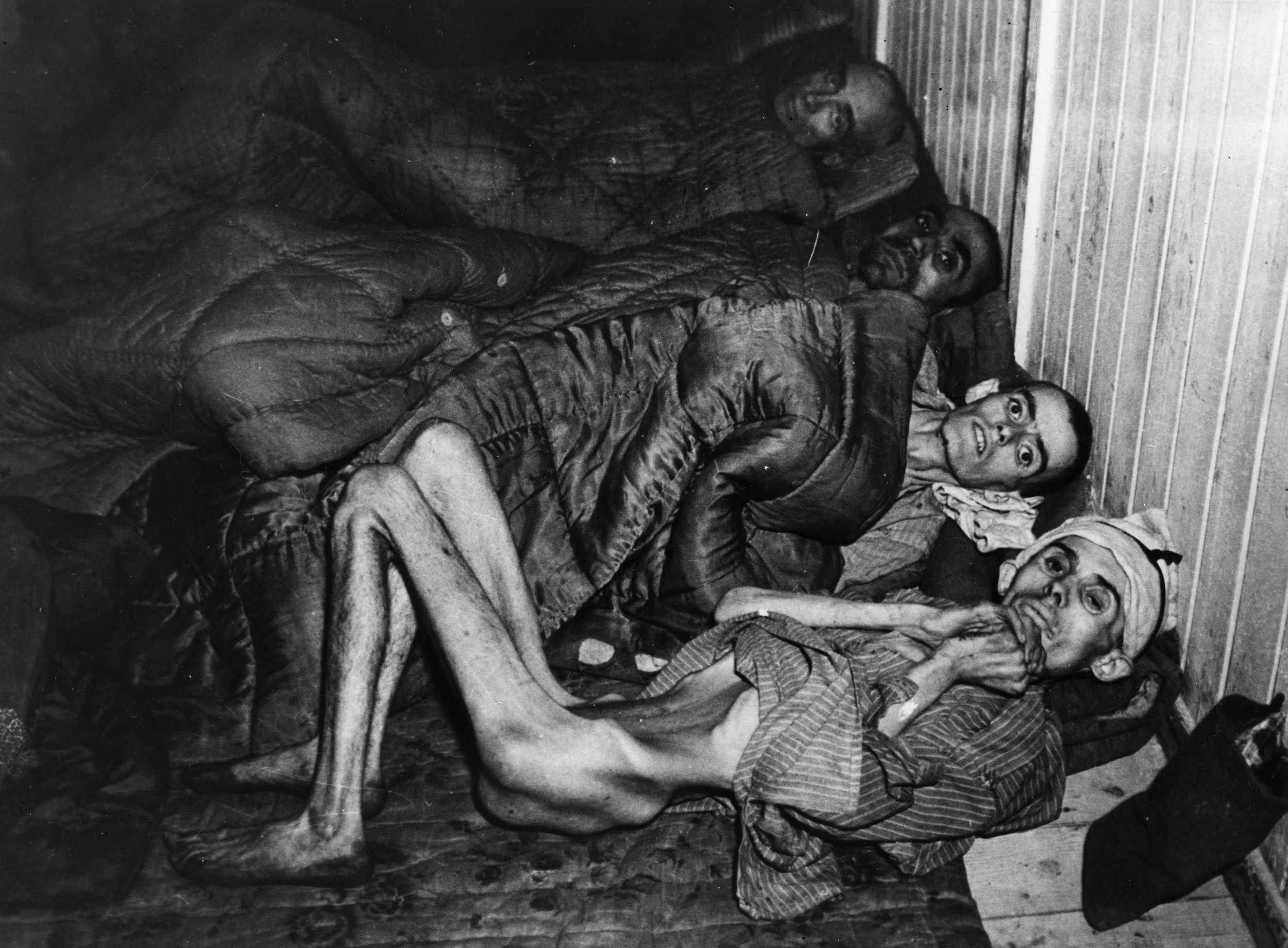 The emaciated condition of the inmates liberated at Buchenwald shocked American soldiers. This Hungarian Jew was starved to such an extent that his backbone is visible from the front of his body.