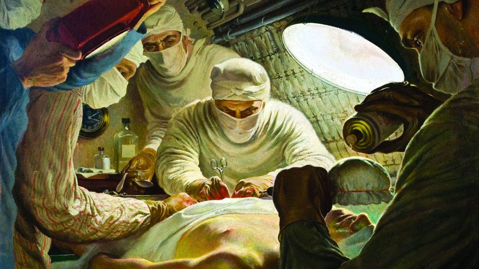 Первая операция в истории. Хирургическая операция. Картина хирургическая операция.