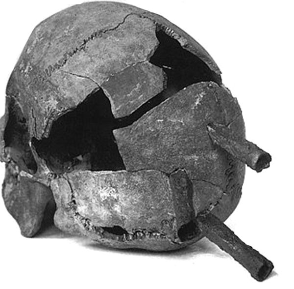 This skull shows the fatal damage inflicted by two war hammer blows and three arrow strikes.