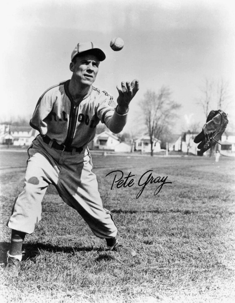 Pete Gray reached the majors despite losing his right arm in a childhood accident. 