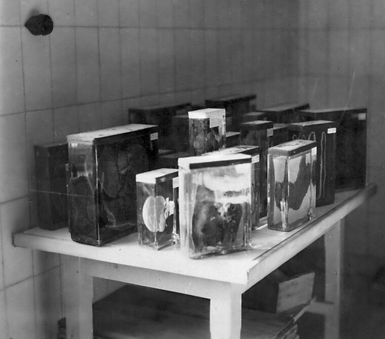 Human organs, preserved in formaldehyde and photographed by Lemick in the camp’s pathology laboratory, were taken from prisoners who died or were killed at Buchenwald. Many of these exhibits were later introduced as evidence in the Nazi war crimes trials.