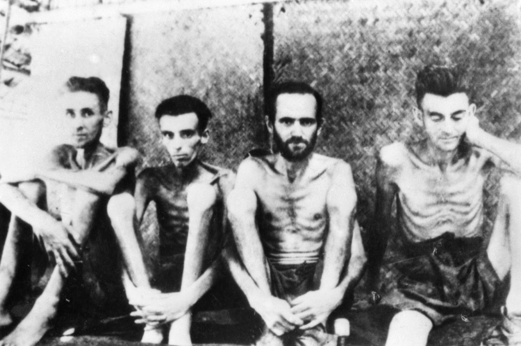 Australian and Dutch POWs, photgraphed in 1943 at Tarsau, Thailand, show the results of malnution and beriberi. 