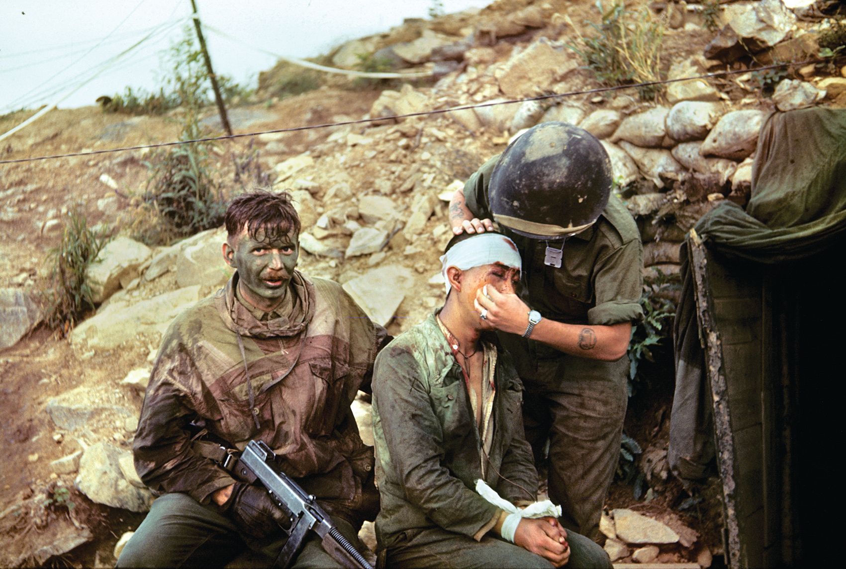 Chinese prisoner Private Wang Teh Shen receiving medical aid after he was captured by Lieutenant Gardner and Corporal Fowler in a snatch patrol on September 24, 1952. After the war, returning Royals POWs said that the attack on Little Gibraltar had been triggered by the daring capture of Shen. 