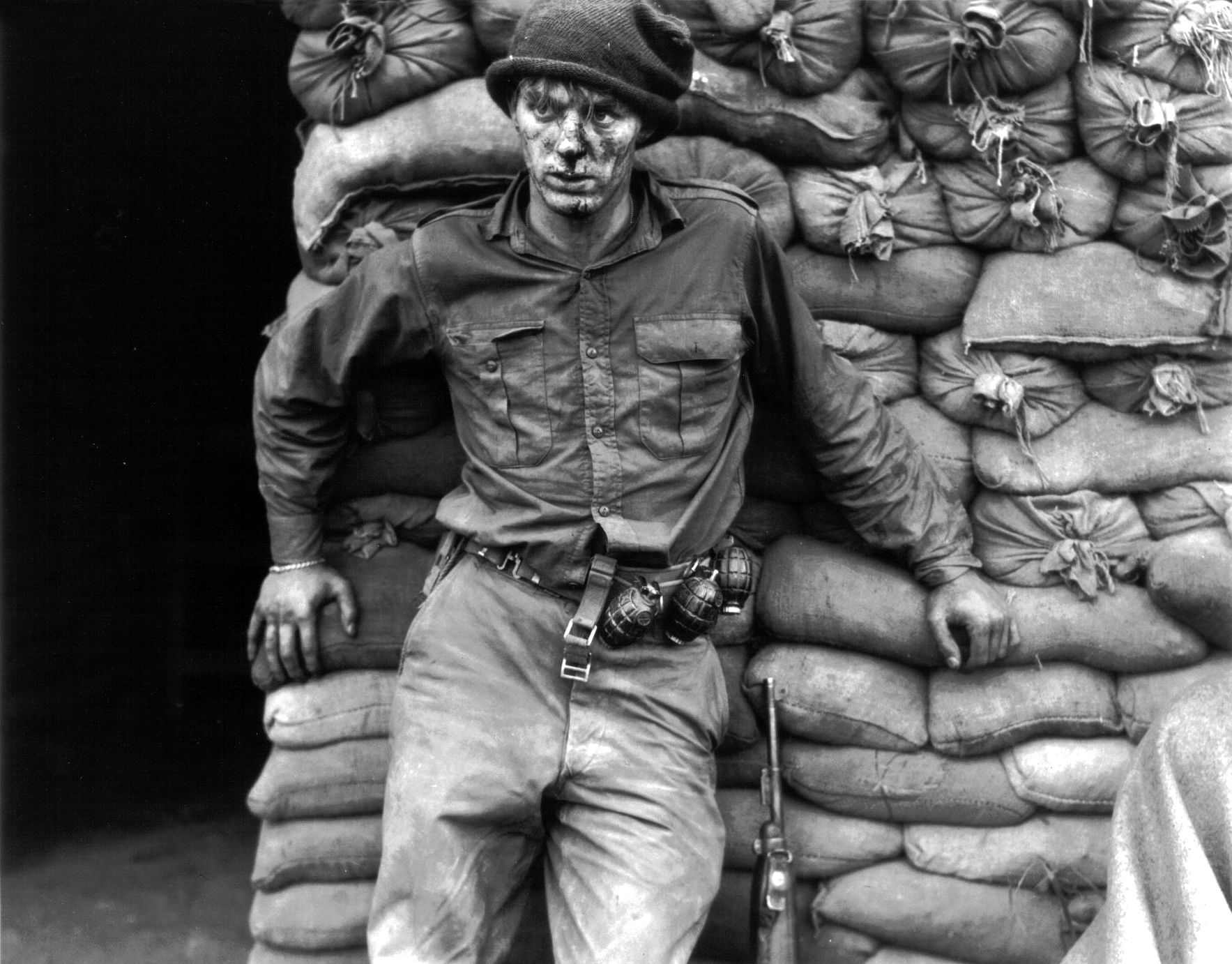 Private Heath Matthews of C Company, 1st Battalion, Royal Canadian Regiment, awaits medical aid for facial wounds sustained in a night patrol in June 1952 during the Korean War.  